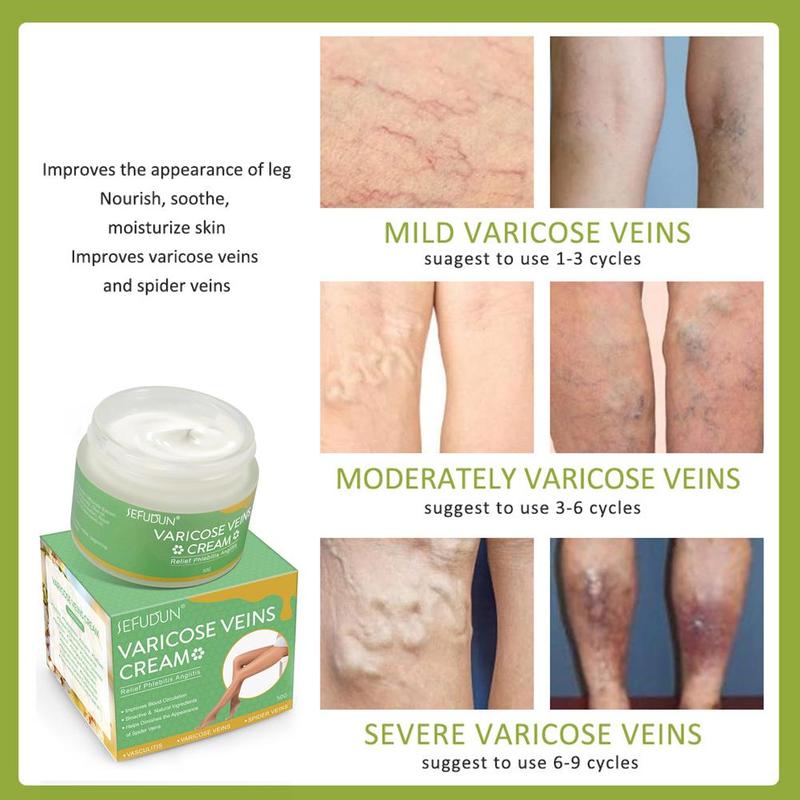 Sefudun Varicose Vein Treatment Cream 50g Painless Removal Spider Vein Pain Varicosity Effective Varicose Healing Cream Varicose Veins Remover for Legs A Bundle of 2 for $25