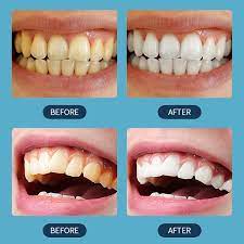 Scoban Whitening Toothpaste, Japanese Scoban Teeth Whitening Toothpaste with Baking Soda, Deep Clean and Stain Removal, Gentle and Effective