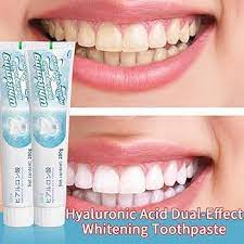 Scoban Whitening Toothpaste, Japanese Scoban Teeth Whitening Toothpaste with Baking Soda, Deep Clean and Stain Removal, Gentle and Effective