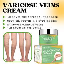 Sefudun Varicose Vein Treatment Cream 50g Painless Removal Spider Vein Pain Varicosity Effective Varicose Healing Cream Varicose Veins Remover for Legs A Bundle of 2 for $25